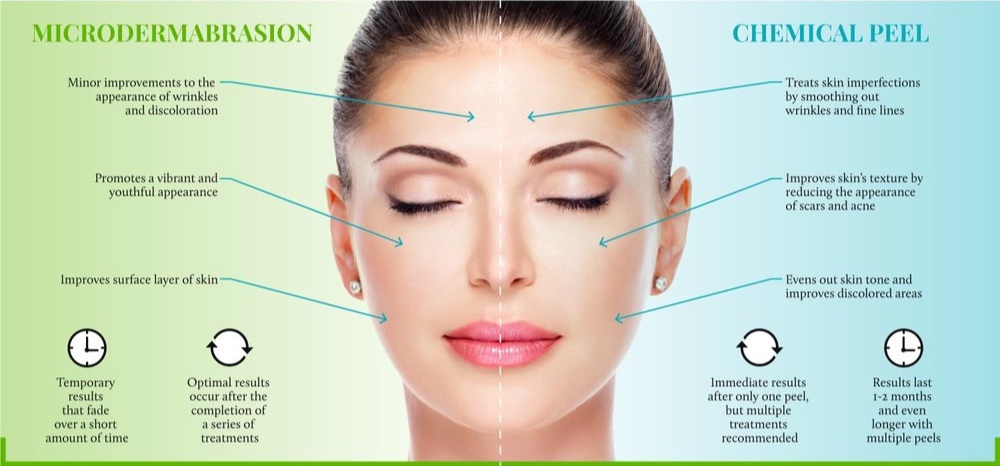 Microdermabrasion Los Angeles