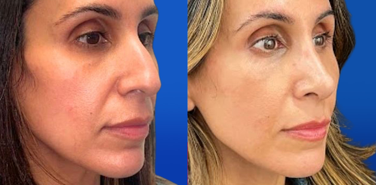 before and after picture