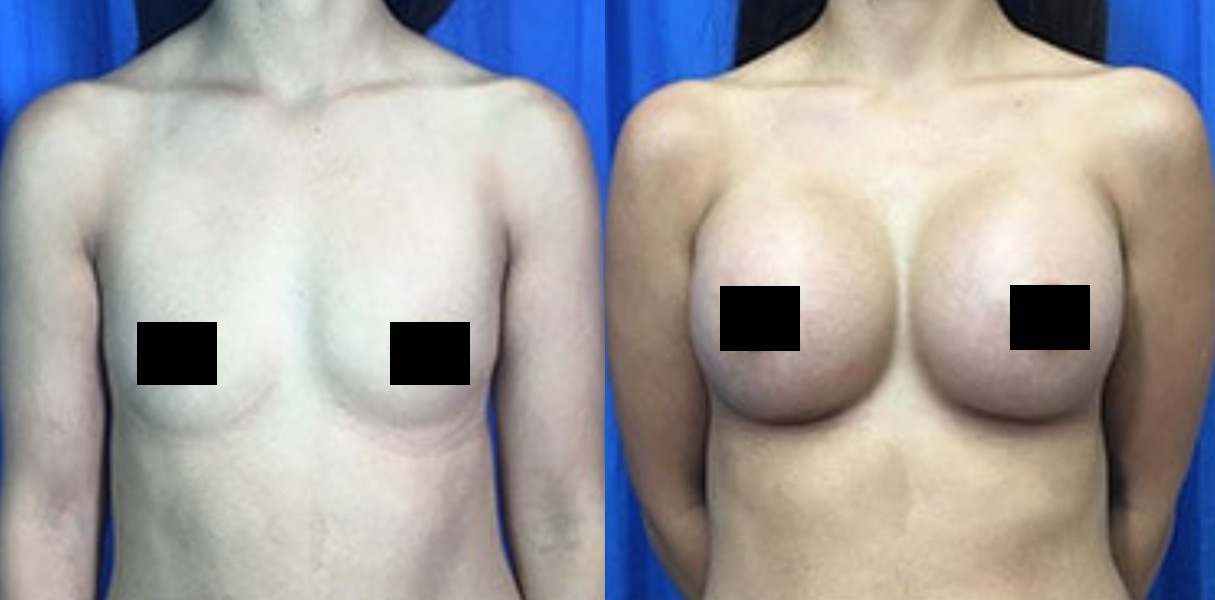 before and after picture